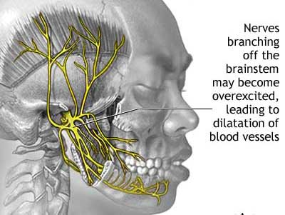 Medicine Acupuncture Herbal Treatment Cure Migraine Herbs Kuala Lumpur Medical Treatment Cure Centre